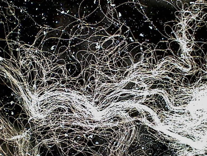 bacteries-filamenteuses bacteries-filamenteuses